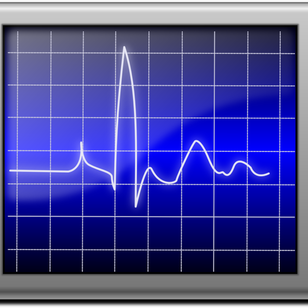 心電図異常で心血管病リスク上昇　京都大が解明　やはり検査は有用