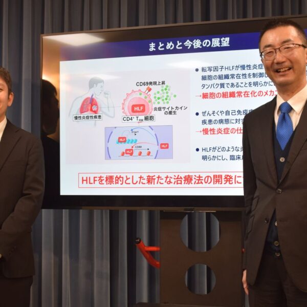 臓器特異的な免疫疾患の要　免疫細胞のメカニズム解明　千葉大など成果