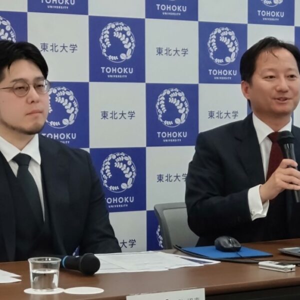 アルツハイマー病記憶障害　ドーパミン不足が一因